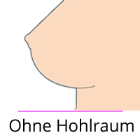 Ohne Hohlraum