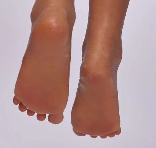 Nicht stehende Füsse